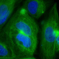 Expression of AcGFP1-tagged tubulin in iPS cells