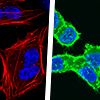 mCherry-Actin/AcGFP1-Actin