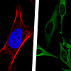 mCherry-Tubulin/AcGFP1-Tubulin
