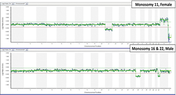 Array CGH comparison chart