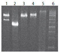 Peak calling and electropherograms of pre- and post-PCR size selection libraries.