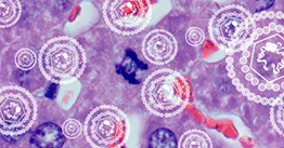 1.10 | Hitting back at Hepatitis B