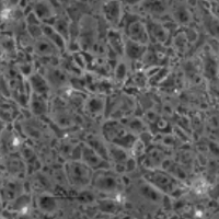 Pluripotent stem cells