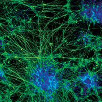 Neural stem cells