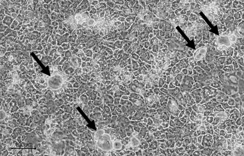 Lipid droplets in Cellartis Enhanced hiPS-HEP cells