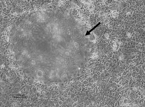 Dome-like structure in Cellartis hiPS-HEP cell culture