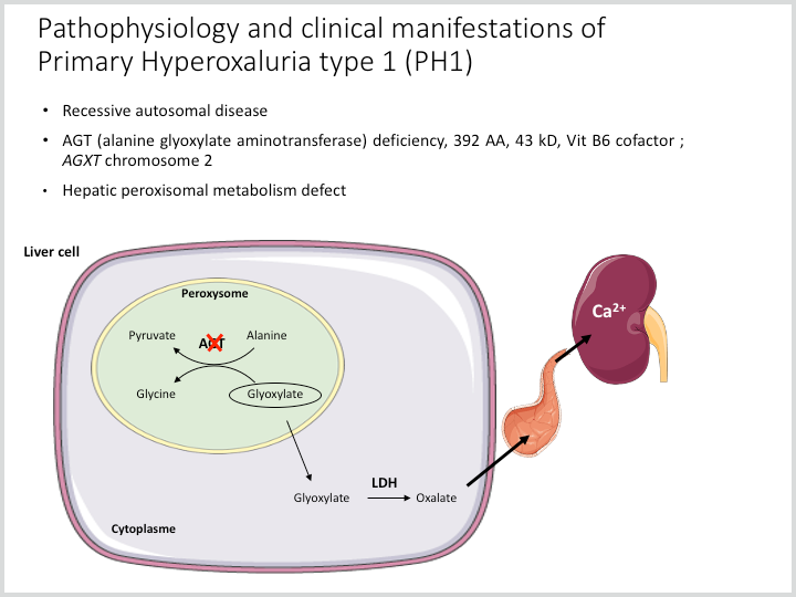 Efficient generation of hiPSC-derived disease model for primary hyperoxaluria type 1