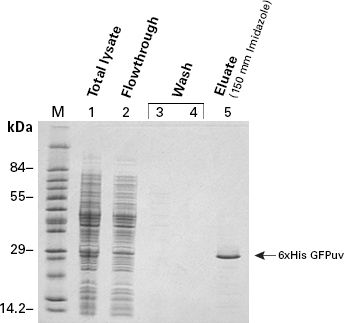 Purification of a his-tagged protein with 8 M urea buffers for a denaturing purification.