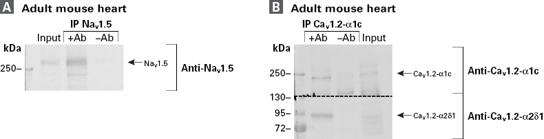 Immunoprecipitation of voltage-gated sodium (Nav1.5) and calcium (Cav1.2-α1c) channels and co-immunoprecipitation of Cav1.2-α2δ1 performed using the Capturem IP & Co-IP Kit.