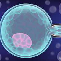 Trophectoderm biopsy for PGT