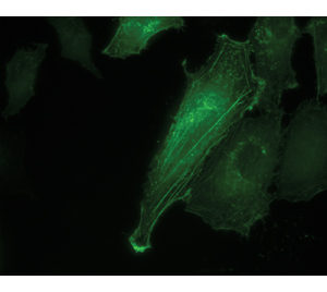 Living Colors AcGFP1 is ideal for fluorescence microscopy applications