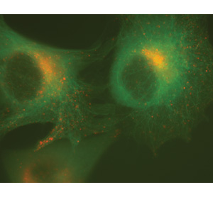 Retroviral vectors expressing AcGFP1 and DsRed-Monomer fluorescent protein fusions