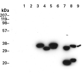 Western blot detection of Reef Coral Fluorescent Proteins by the Anti-RCFP Polyclonal Pan Antibody