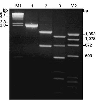 PCR amplification of the full coding region from human TFR mRNA