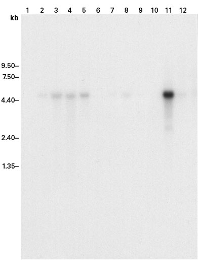 ExpressHyb Hybridization Solution reduces background for a clean, sensitive hybridization