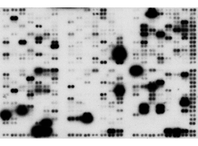 Detection of gene expression levels in human placenta using ExpressHyb Hybridization Solution