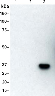 Western blot detection of a DmrC-tagged protein with the DmrC Polyclonal Antibody (Cat. No. 635091)