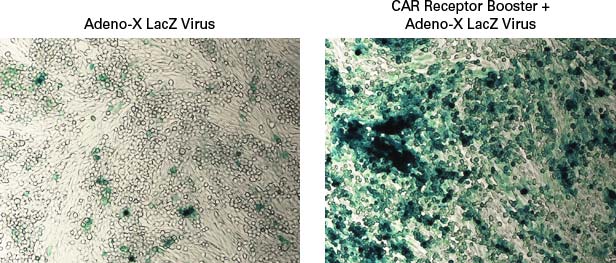 Adenoviral transduction of CHO-K1 cells is facilitated by pre-treatment with CAR Receptor Booster