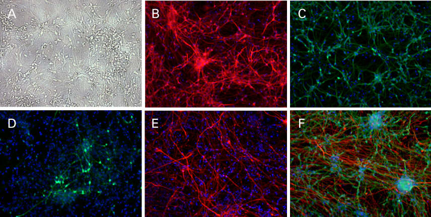 Adherent human neural stem cells differentiated in RHB-A culture medium express neural lineage markers, including microtubule associate protein 2 (Panel B), neuron-specific class III beta-tubulin (Panel C), gamma amino butyric acid (Panel D), and glial fibrillary acidic protein (Panel E)