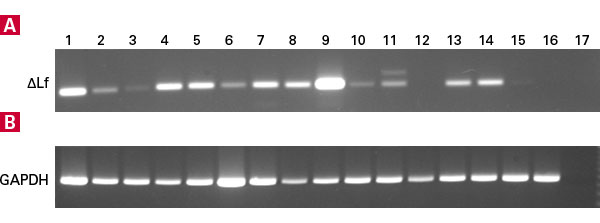 Tissue expression patterns of two mRNAs in MTC Human Panels I & II