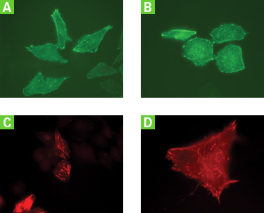 Cloning of PCR-amplified alpha-actinin directly into four different In-Fusion Ready prelinearized DsRed-Monomer and AcGFP1 vectors