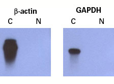 DSN-Normalization reduces the amount of highly abundant transcripts