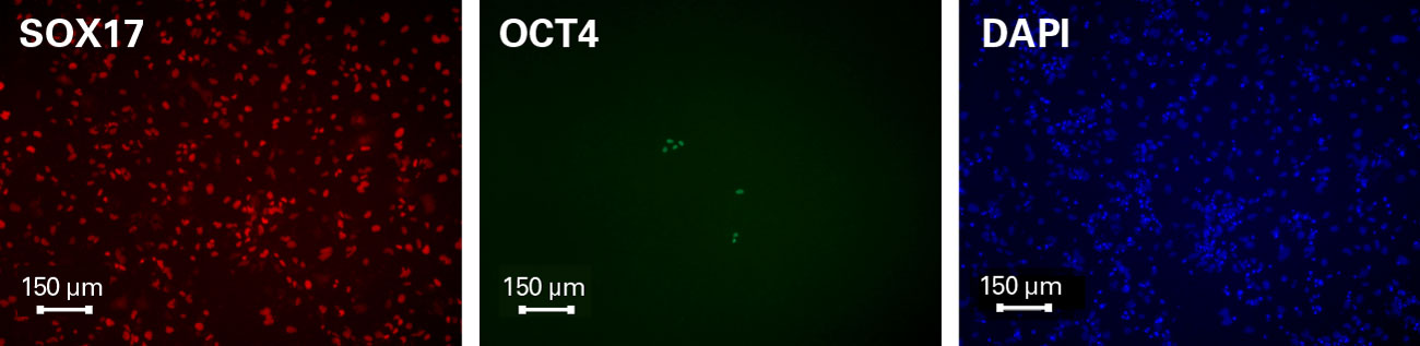 Immunocytochemistry of Cellartis Definitive Endoderm Cells (from ChiPSC18)