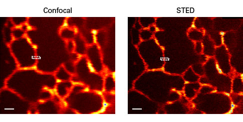 E2-Crimson is useful for confocal and STED (stimulated emission depletion) microscopy