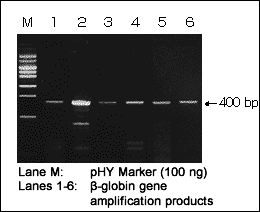 Amplification of the beta-globin gene, using DEXPAT to extract genomic DNA from paraffin sections 