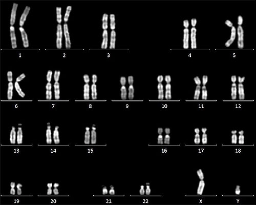 No numerical or structural abnormalities identified in hMSC cultured in Cellartis MSC Xeno-Free Culture Medium 
