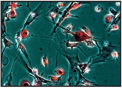 Human bone marrow mononuclear cells were cultured in the presence of  Macrophage Colony Stimulating Factor (+M-CSF) and +Vitamin D3