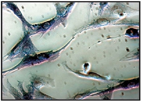 Human bone marrow mononuclear cells were cultured in the presence of Macrophage Colony Stimulating Factor (+M-CSF)