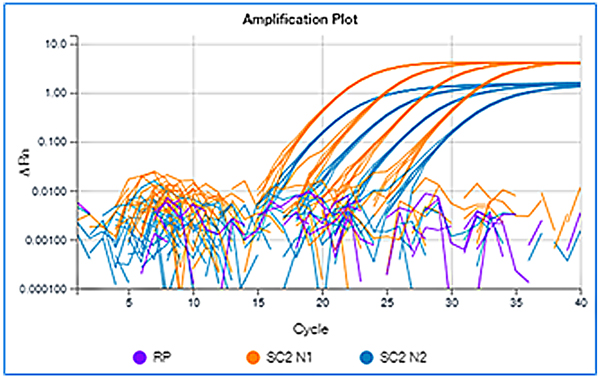 Detection of the SARS-CoV-2 nucleocapsid gene by ddPCR