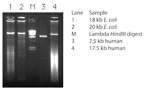 Amplification of long products using Takara Z-Taq DNA Polymerase