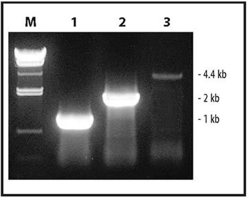 RT-PCR Amplification from Total RNA using the One Step RNA PCR Kit
