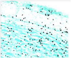 STEM101 detects nuclei of transplanted human neural stem cells in the olfactory bulb of a mouse brain
