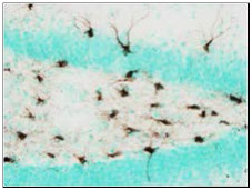 STEM121 detects migration and differentiation of transplanted human neural stem cells in the hippocampus of a mouse brain