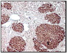 STEM121 detects presence of transplanted human liver engrafting cells in a mouse liver