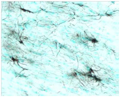 STEM123 detects human GFAP+ astrocytes differentiated from human neural stem cells after transplantation into a mouse brain