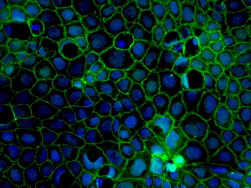 Immunostaining of tight junction protein ZO-1
