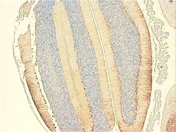 Immunohistochemical detection of neural progenitor cells in mouse cerebellum