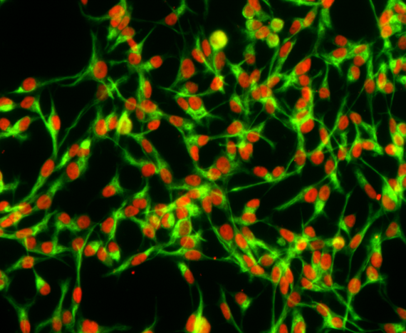Adherent mouse neural stem cells cultured in RHB-A medium supplemented with epidermal growth factor and fibroblast growth factor-2 express sex determining region Y-box 2 (Sox2, red) and Nestin (green)
