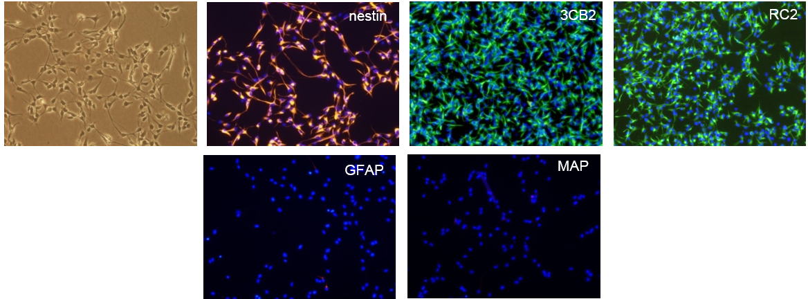 Adherent mouse neural stem cells cultured in RHB-A medium supplemented with epidermal growth factor and fibroblast growth factor-2 express neural stem cell markers, including Nestin, Vimentin (3CB2), radial glial cell marker-2 (RC2), glial fibrillary acidic protein (GFAP), and microtubule associate protein (MAP)
